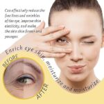 Hoygi Eye Roller for Puffy Eyes Castor Oil and Frankincense Eye Roller
