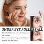 Hoygi Eye Roller for Puffy Eyes Castor Oil and Frankincense Eye Roller