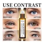 Hoygi Eye Roller for Puffy Eyes Castor Oil and Frankincense Eye Roller