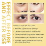 Hoygi Eye Roller for Puffy Eyes Castor Oil and Frankincense Eye Roller